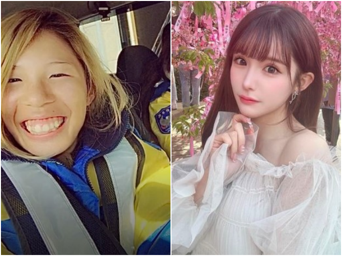 Kisah Influencer Jepang Hirase Airi yang Hidupnya Berubah Usai Operasi Plastik Rp2 Miliar