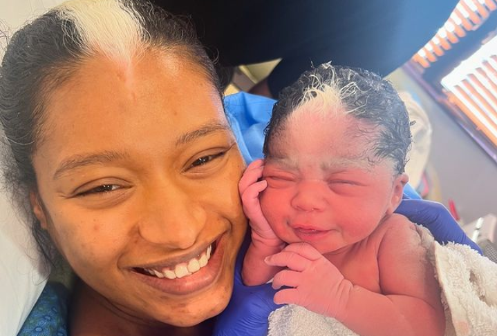 Kisah Ibu dan Anak dengan Tanda Lahir Rambut yang Sama, Netizen: Warisan Genetik Paling Unik!