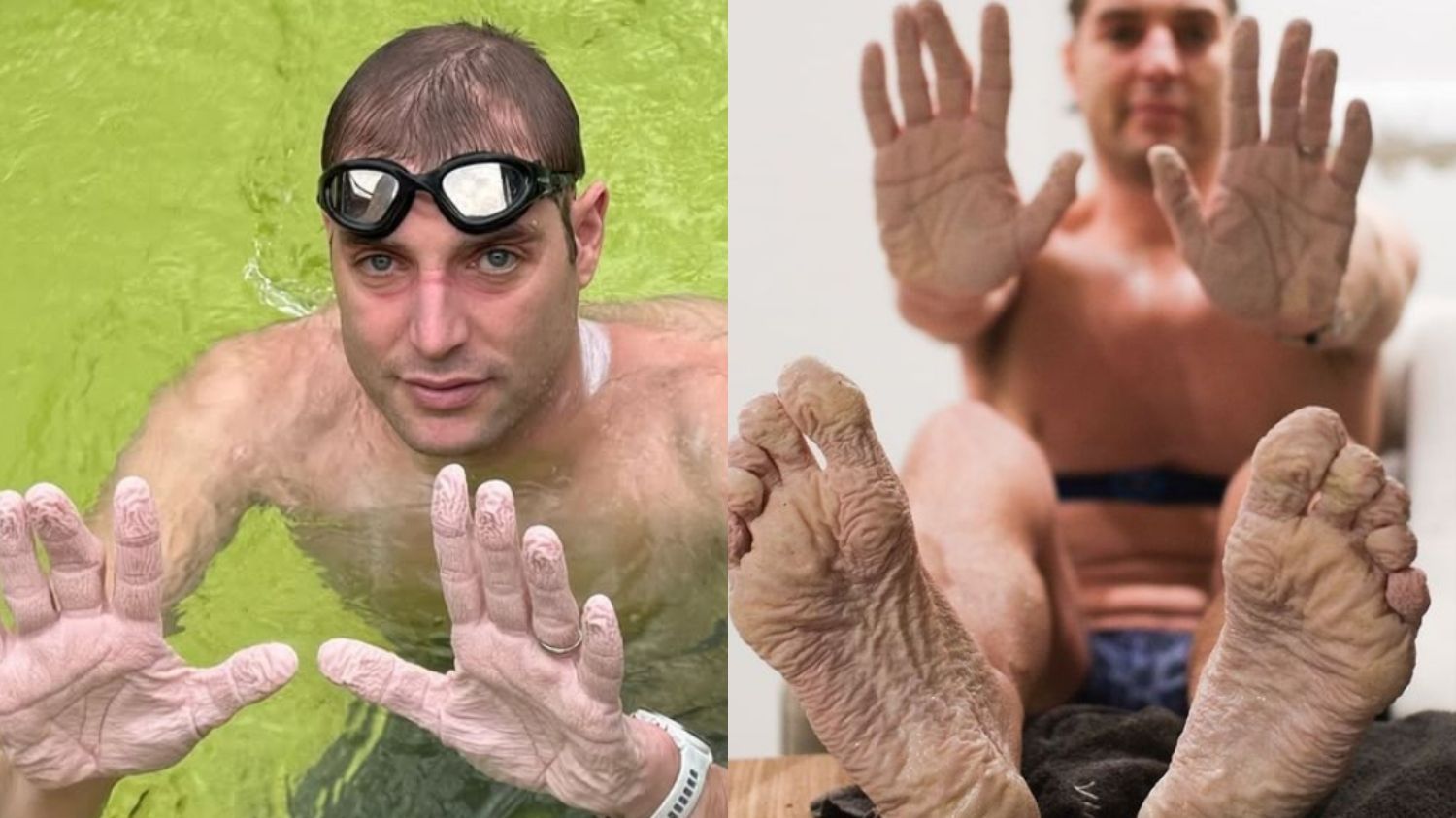 Kisah Inspiratif Penyintas Leukimia Pecahkan Rekor Berenang 45 Jam untuk Amal Kanker