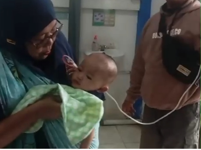 Bayi 5 Bulan di Jember Alami Usus Bocor dan Hernia, Tunggu Operasi dengan Bantuan DPRD