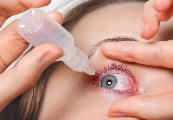 Apakah Obat Tetes Mata Membatalkan Puasa? Simak Penjelasan Lengkapnya