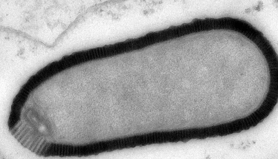 Akibat Perubahan Iklim, Virus 'Zombie' Kuno yang Membeku di Lapisan Es Selama 50.000 Tahun Kini Mencair