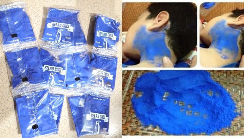 Mengulik Mitos Blau Bisa Obati Gondongan, Begini Faktanya!