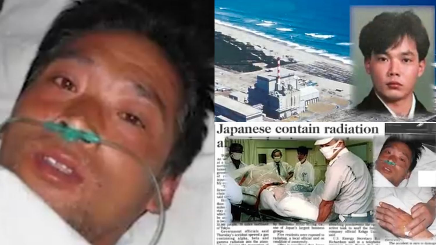 Kisah Tragis Hisashi Ouchi, Dari Kecelakaan Nuklir hingga Jadi Orang Paling Radioaktif Sepanjang Sejarah