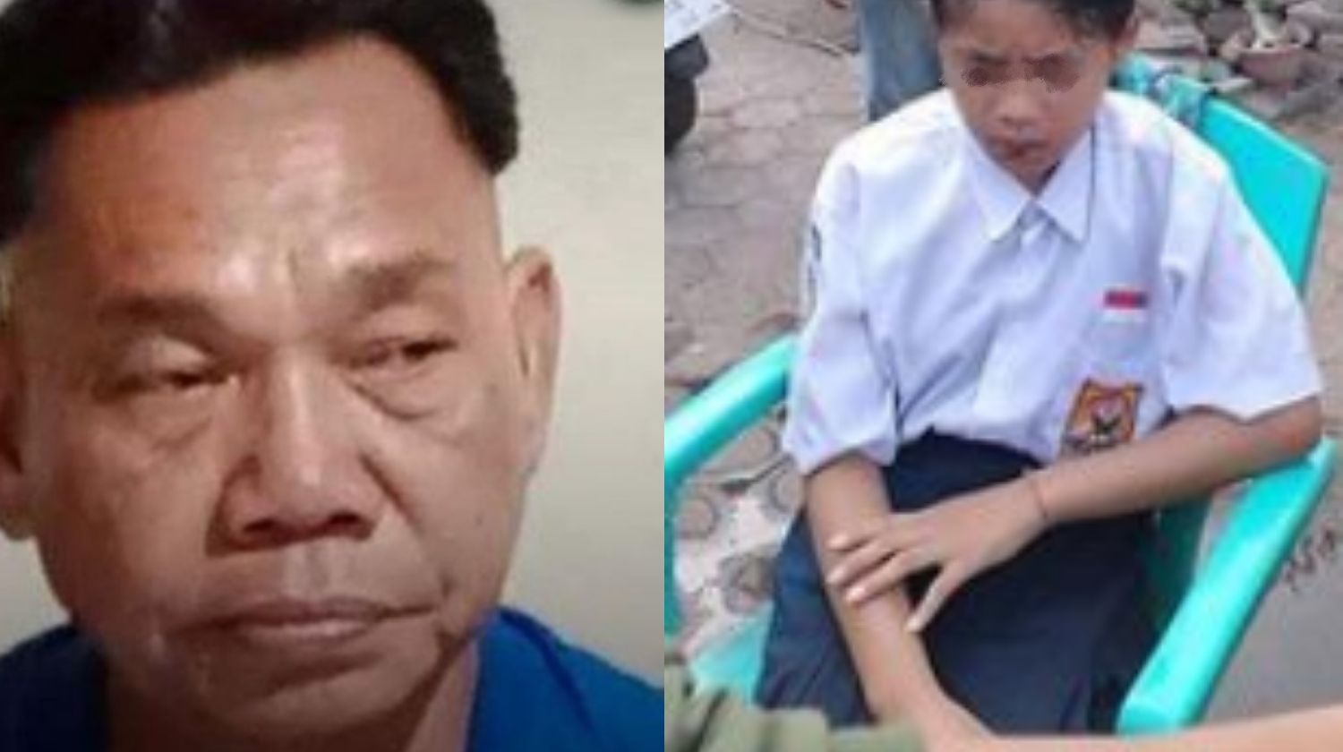 Kisah Tragis Pria 49 Tahun Nekat Siram Siswi SMP dengan Air Keras karena Cinta Ditolak