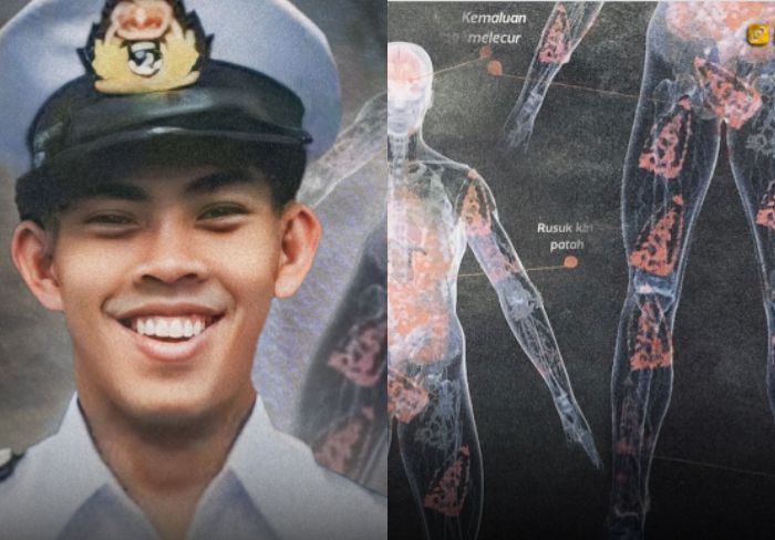 Tragedi Taruna AL yang Tubuhnya Disetrika 90 Kali hingga Berakhir Tak Bernyawa