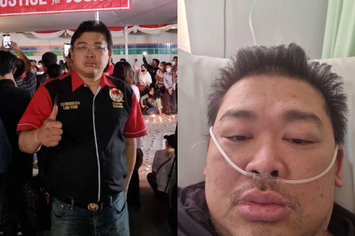 Profil Alvin Lim, Pengacara Vokal yang Meninggal Dunia Akibat Komplikasi Gagal Ginjal