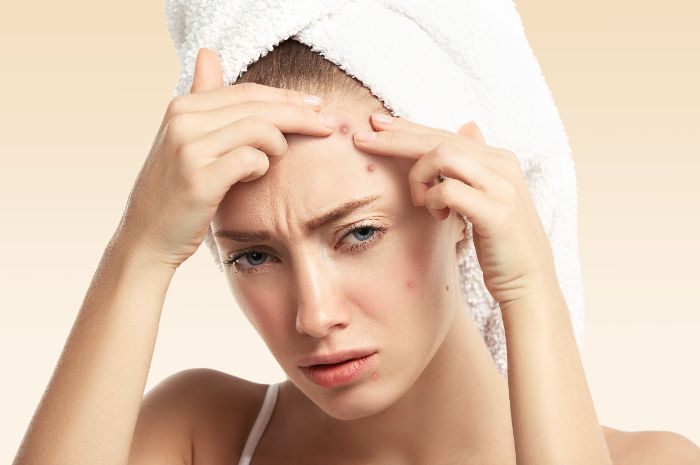 5 Skincare Routine untuk Kulit Berminyak dan Berjerawat