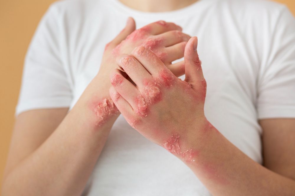 Manfaat Ceramide untuk Jaga Kelembapan Kulit Tahan Lama , Simak Penjelasan Dermatolog yang Viral di TikTok