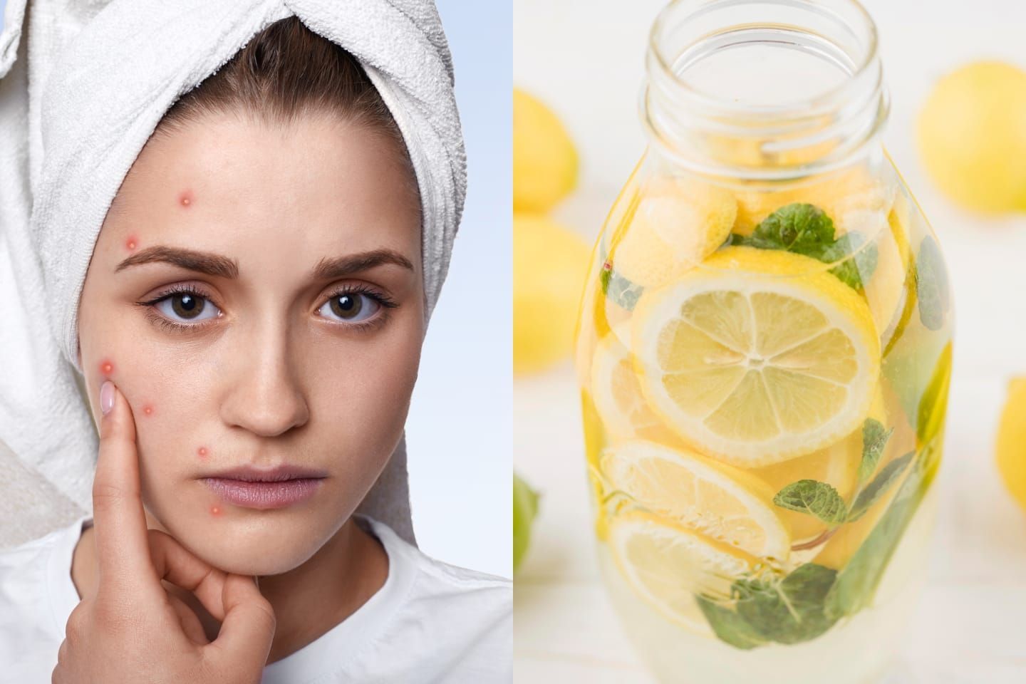 4 Minuman Sehat yang Diklaim Ampuh Hilangkan Jerawat Cepat