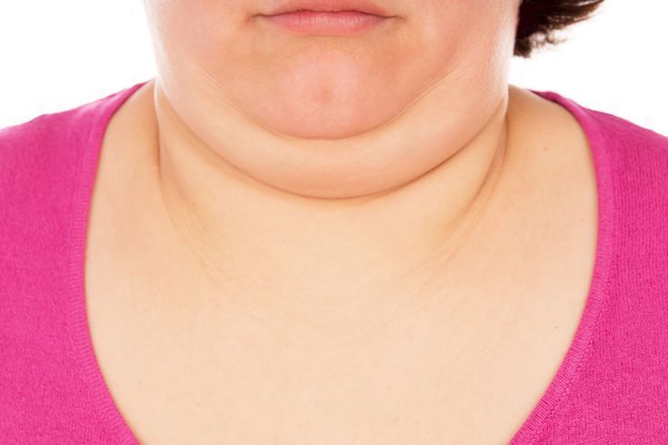 Cara Alami Hilangkan Double Chin: Solusi Praktis untuk Wajah Ideal