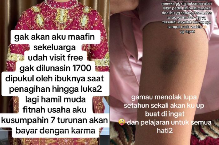 Viral MUA di Aceh Curhat Tak Dibayar Klien, Malah Dianiaya saat Hamil Muda