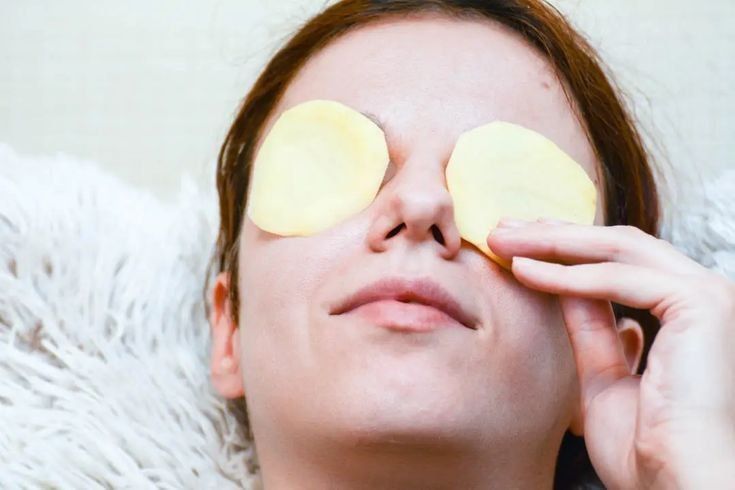 6 Manfaat Masker Kentang untuk Kulit, Ampuh Menyamarkan Kantong Mata