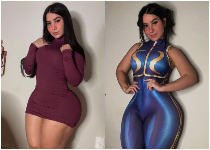 Kisah Model Seksi Pengidap Lipoedema, Penyakit Langka Bikin Pahanya Besar tapi Badan Langsing