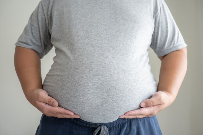 Studi: Masyarakat di Negara Berkembang Lebih Rentan Terkena Obesitas