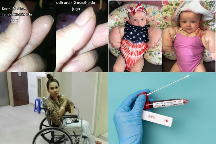 Kaleidoskop Health 2023: Cacing Kremi Keluar dari Miss V Ibu 2 Anak hingga Gejala Covid-19 Varian JN.1 Terdeteksi di Indonesia