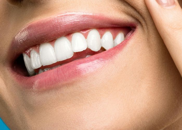 5 Cara Mudah Menjaga Kesehatan Gusi agar Tetap Sehat