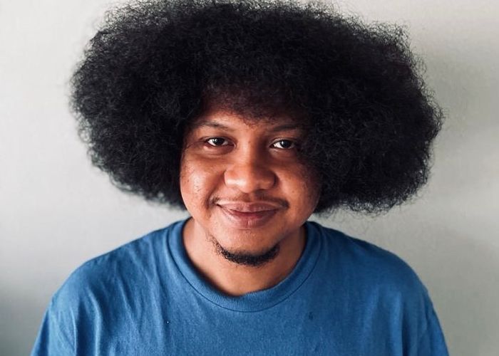Fakta-Fakta Anemia Aplastik, Penyakit Langka yang Diderita Babe Cabita Sebelum Meninggal Dunia