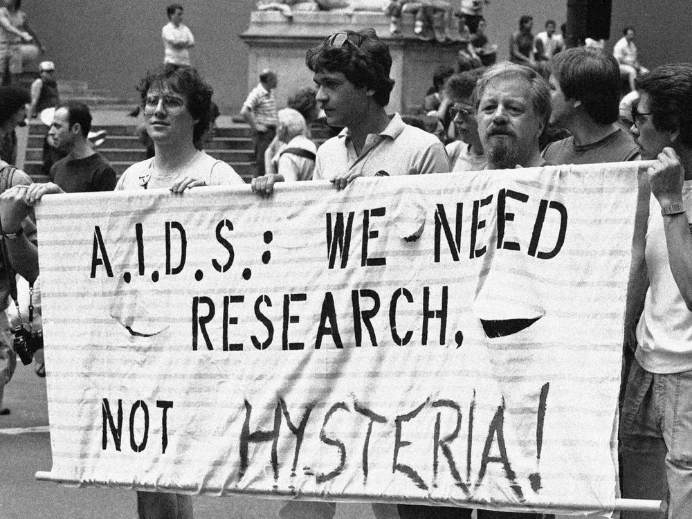 Sejarah Singkat HIV dan AIDS serta Perkembangannya