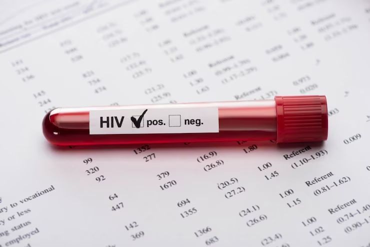 9 Mitos dan Fakta Tentang HIV dan AIDS, Nomor 5 Paling Umum!