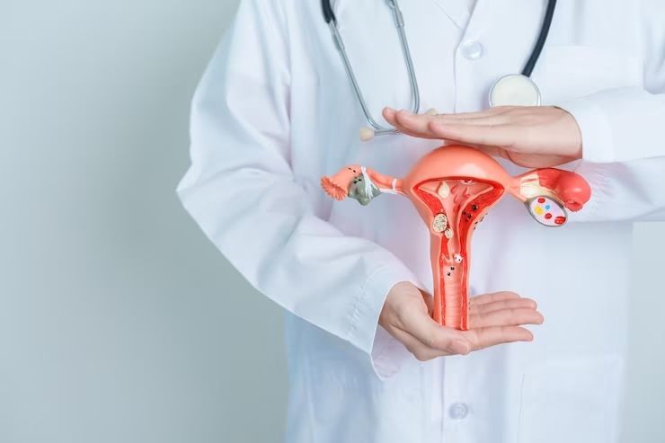 5 Kebiasaan Hidup Sehat untuk Mencegah Kanker Ovarium