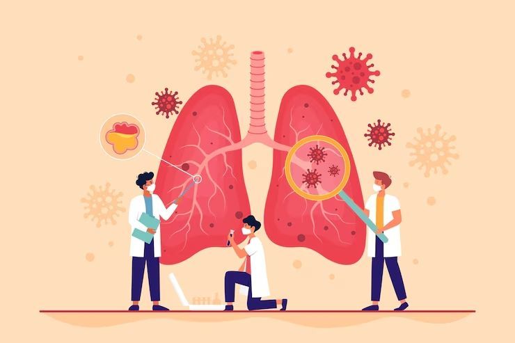 Pneumonia Sama dengan Bronkitis? Ini 10 Mitos dan Fakta yang Sering Beredar di Masyarakat