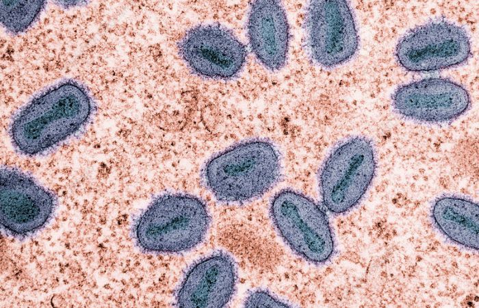 Filipina Deteksi Kasus Virus MPOX Tahun Ini, Belum Diketahui Pasti Jenisnya