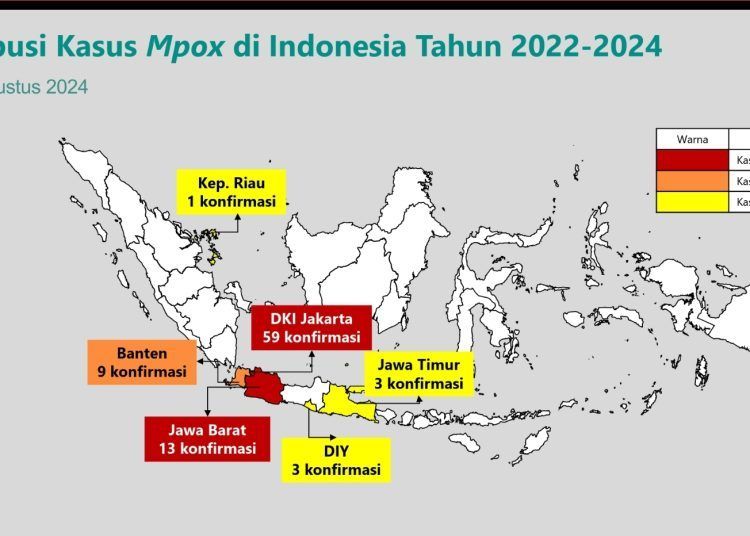 Kemenkes Umumkan 88 Kasus Mpox Cacar Monyet, Begini Varian yang Mewabah di Indonesia