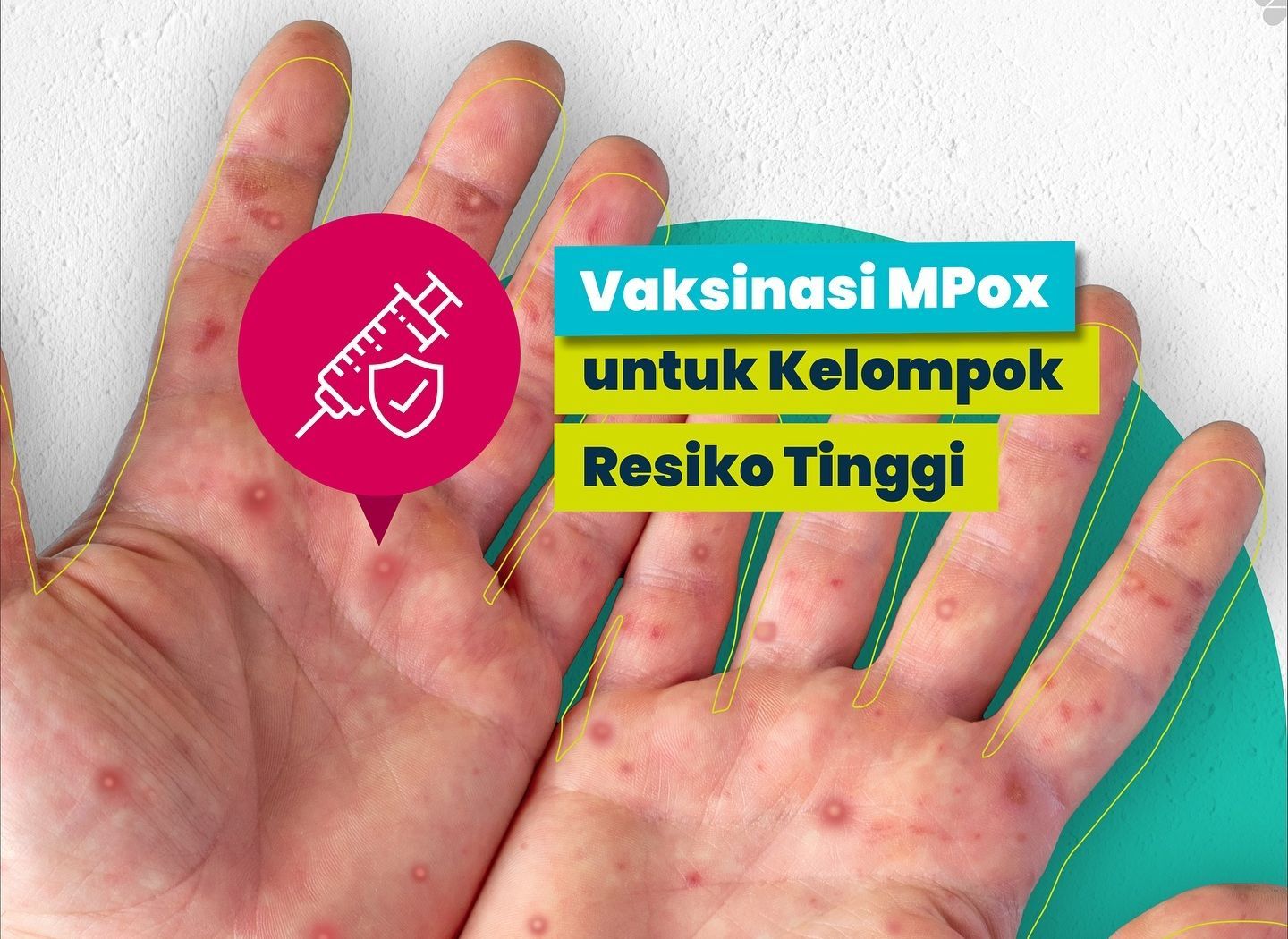 Tidak Semua Orang Bisa Menerima Vaksin MPox, Begini Syaratnya!