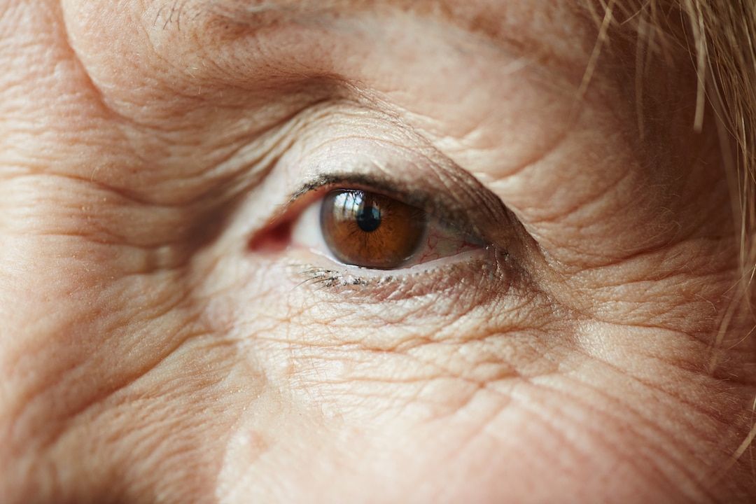 Retinopati Diabetika Rawan Dialami Pasien Diabetes, Penyakit Apa Ini?