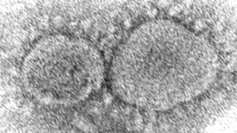 CIA: COVID-19 Kemungkinan Besar Berasal dari Kebocoran Laboratorium