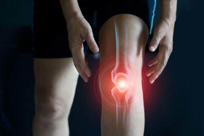 Lutut Mulai Nyeri? Kenali Osteoartritis dan Jenis Perawatannya