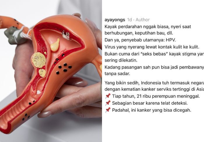 Dokter Ini Bagikan Cerita Seorang Wanita yang Mengira Cuma Haid Deras, Ternyata Kanker Serviks