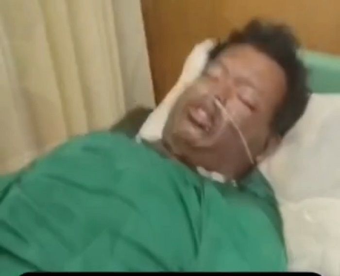 Gegara Kesal, Suami di Jaktim Tega Bakar Istri dan Dua Anaknya
