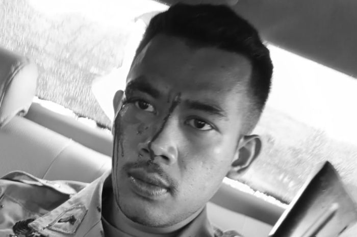 Satgas Damai Cartenz Diserang OTK di Papua, 1 Polisi Terluka Kena Kapak