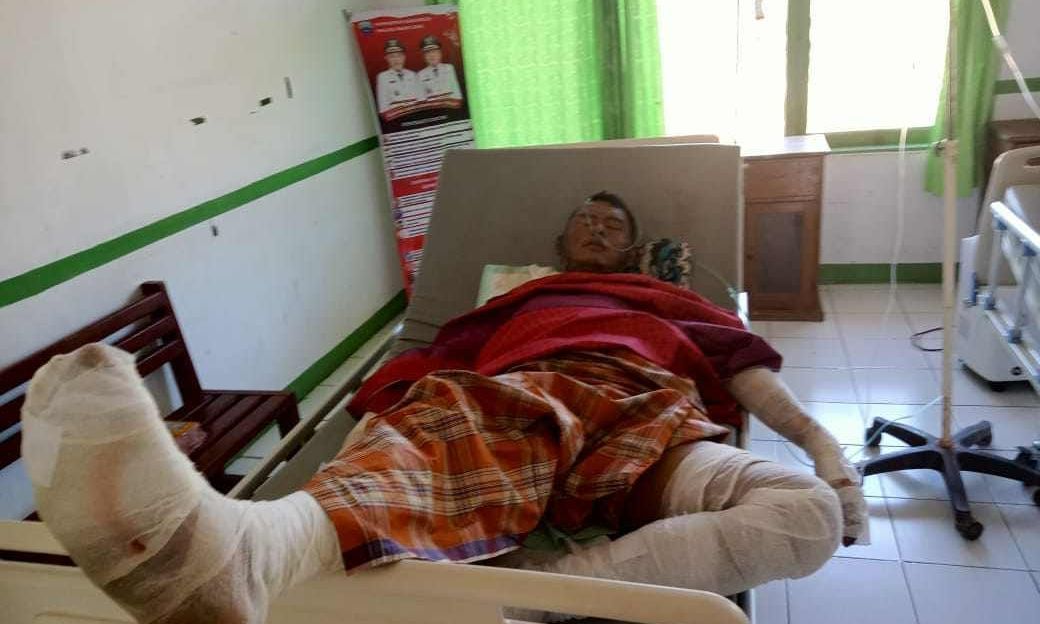 Kapal Terbakar di Dermaga Tepa Maluku Barat Daya, 1 ABK Tewas, 3 Luka Bakar
