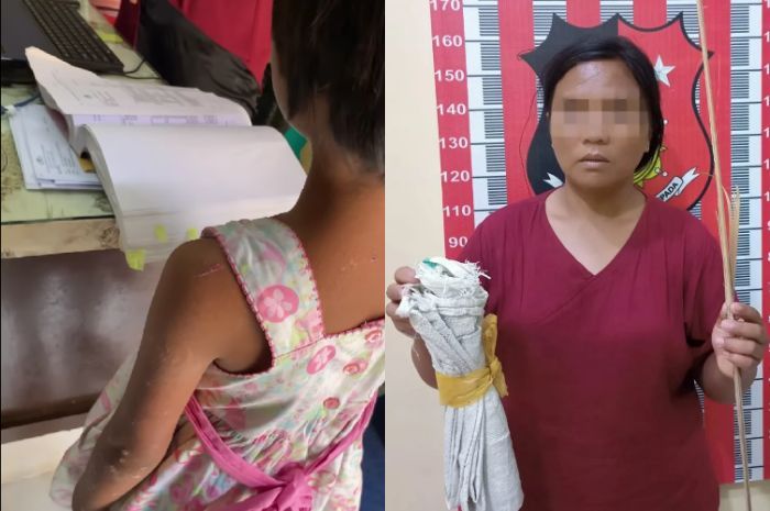 Miris, Bocah Perempuan di Tapteng Dianiaya dan Dimasukkan ke Karung oleh Tantenya