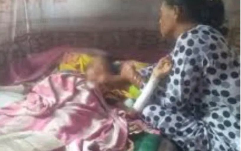 Tragis! Siswi SD Tewas Dibakar Teman di Sekolah,  Hingga Meninggal Dunia