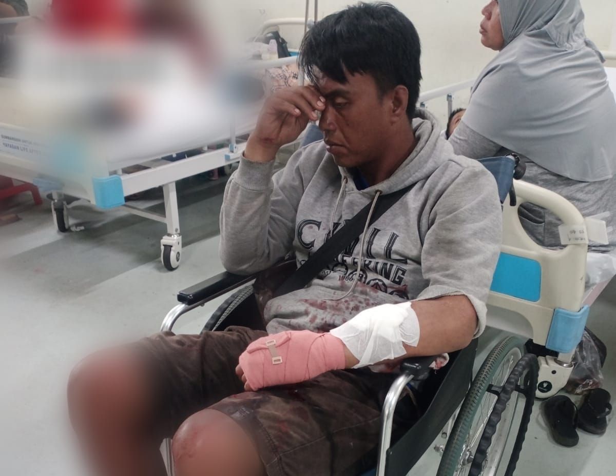 Tukang Parkir di Jakbar Dibantai Teman Sendiri, Kaki-Tangan Alami Luka Bacok