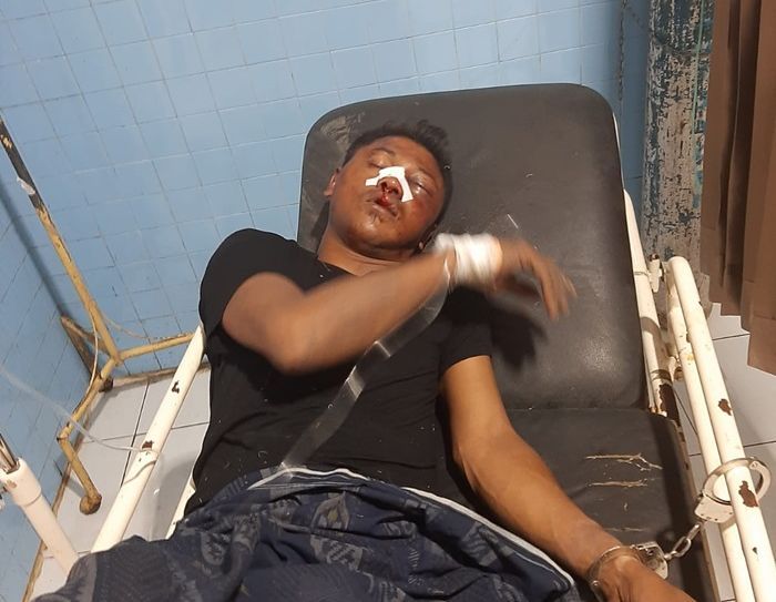 Diduga Curi Motor, Pria di Jember Nyaris Tewas Diamuk Massa