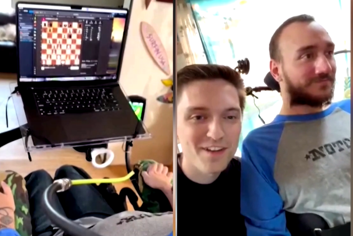 Pasien Pertama Neuralink Berhasil Kendalikan Komputer Pakai Pikiran: Bisa Main Catur dan Video Game