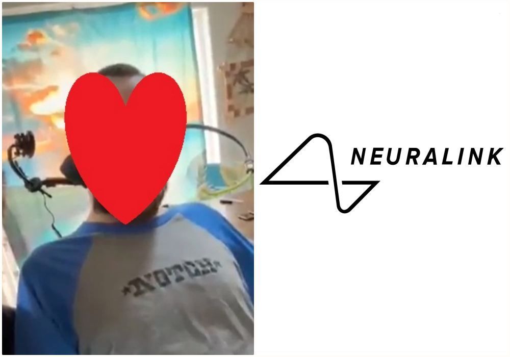 Neuralink Umumkan Manusia Pertama yang Mendapatkan Implan Chip Otak, Ini DIa Sosoknya