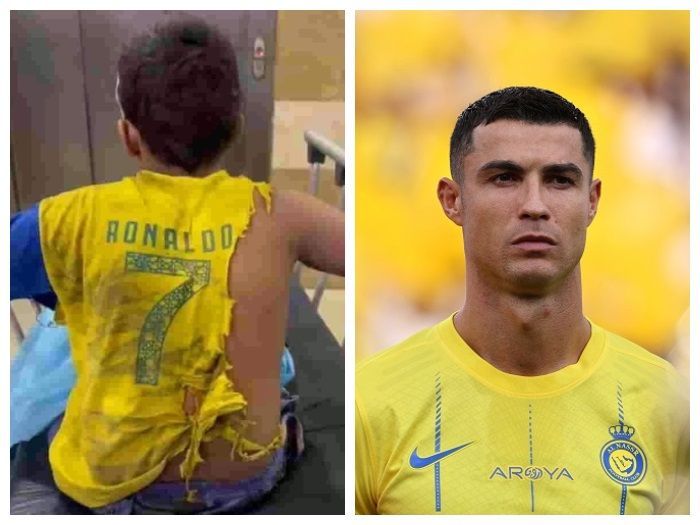 Viral! Bocah Gaza jadi Korban Rudal Israel Pakai Jersey Al-Nassr, Idamkan Cristiano Ronaldo