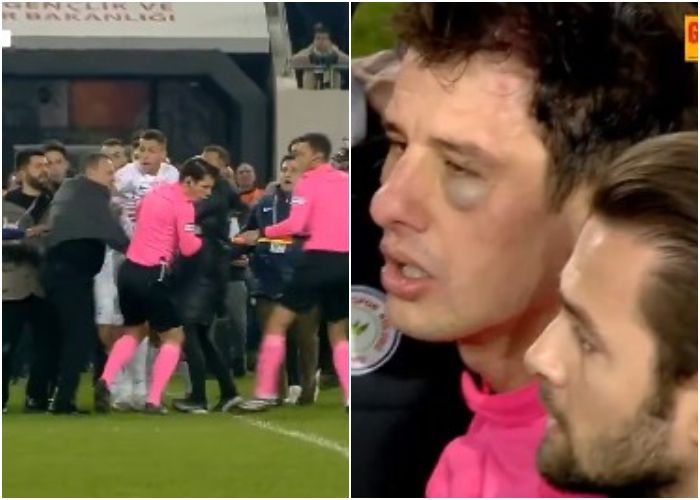 Viral Presiden Klub Ankaragucu Pukul Wajah Wasit hingga Tersungkur di Liga Turki, Mata Bengkak dan Membiru