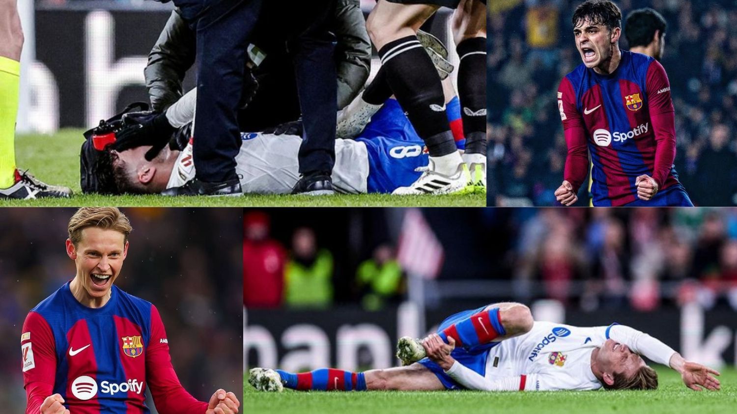 Mengenal Jenis Cedera dalam Sepak Bola, Terbaru Menimpa Pedri & De Jong di Pertandingan Barcelona VS Bilbao